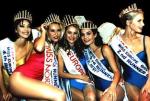 Miss Albania 1994